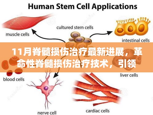 革命性脊髓损伤治疗技术，智能脊髓修复系统引领生活变革的进展