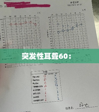突发性耳聋60： 