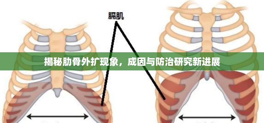 揭秘肋骨外扩现象，成因与防治研究新进展
