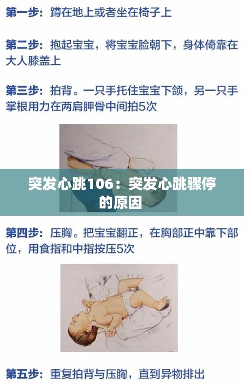 突发心跳106：突发心跳骤停的原因 