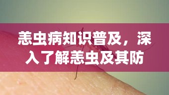 恙虫病知识普及，深入了解恙虫及其防治方法