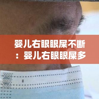 婴儿右眼眼屎不断：婴儿右眼眼屎多又流泪是怎么回事 