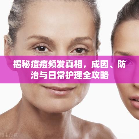 揭秘痘痘频发真相，成因、防治与日常护理全攻略