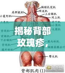揭秘背部玫瑰疹，症状、诱因与治疗方法大解析