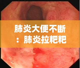 鸟骇鼠窜 第2页