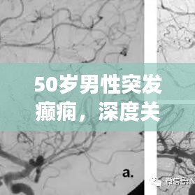 50岁男性突发癫痫，深度关注健康之路，全面理解癫痫症状与防治