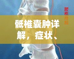 骶椎囊肿详解，症状、治疗与预防，百度权威收录，一网打尽！