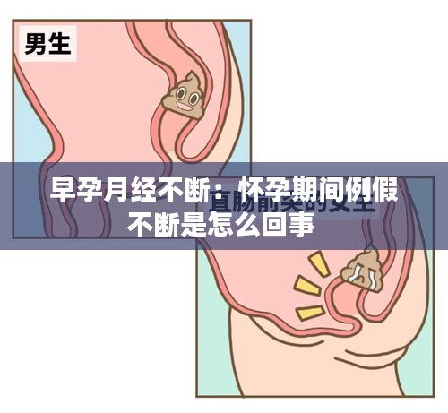 早孕月经不断：怀孕期间例假不断是怎么回事 