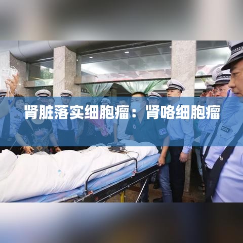 肾脏落实细胞瘤：肾咯细胞瘤 