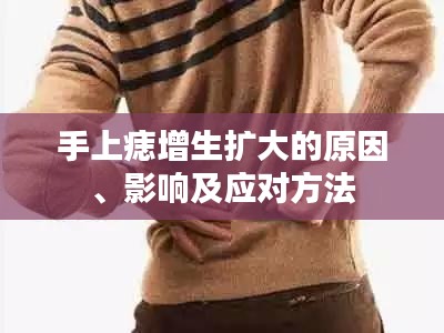 手上痣增生扩大的原因、影响及应对方法