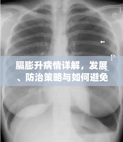膈膨升病情详解，发展、防治策略与如何避免恶化
