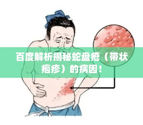 百度解析揭秘蛇盘疮（带状疱疹）的病因！