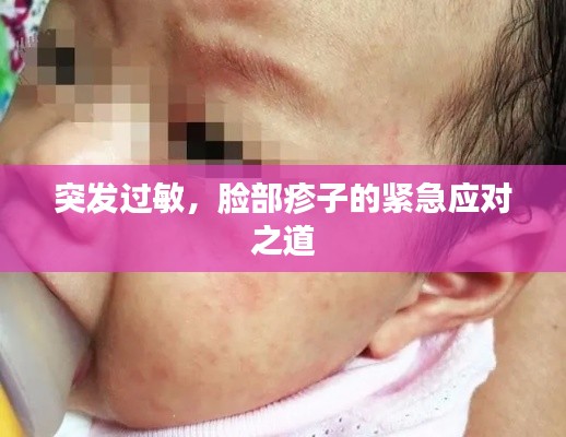 突发过敏，脸部疹子的紧急应对之道