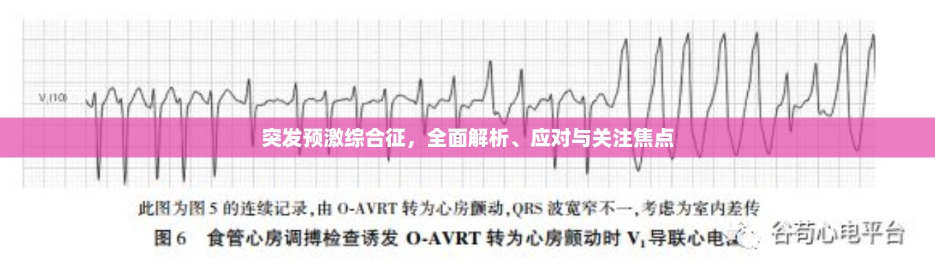 突发预激综合征，全面解析、应对与关注焦点