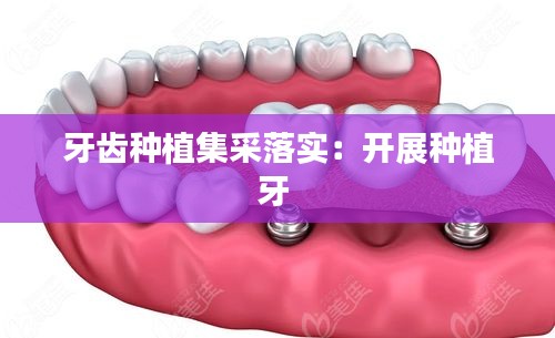 牙齿种植集采落实：开展种植牙 