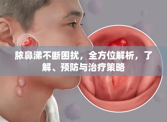 脓鼻涕不断困扰，全方位解析，了解、预防与治疗策略